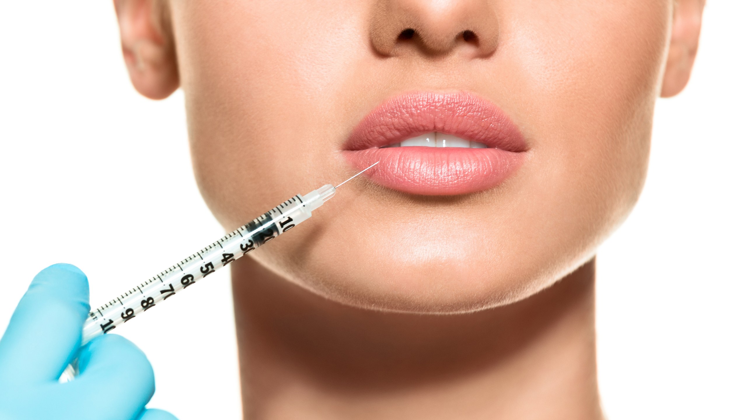 Lips Filler Injection - Nilforoushzadeh Clinic